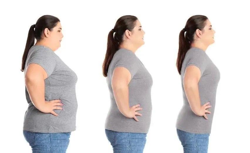 Liposuction Timing After GLP-1 Weight Loss: What You Need to Know